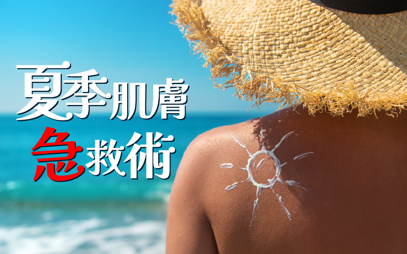 夏季肌膚急救術封面